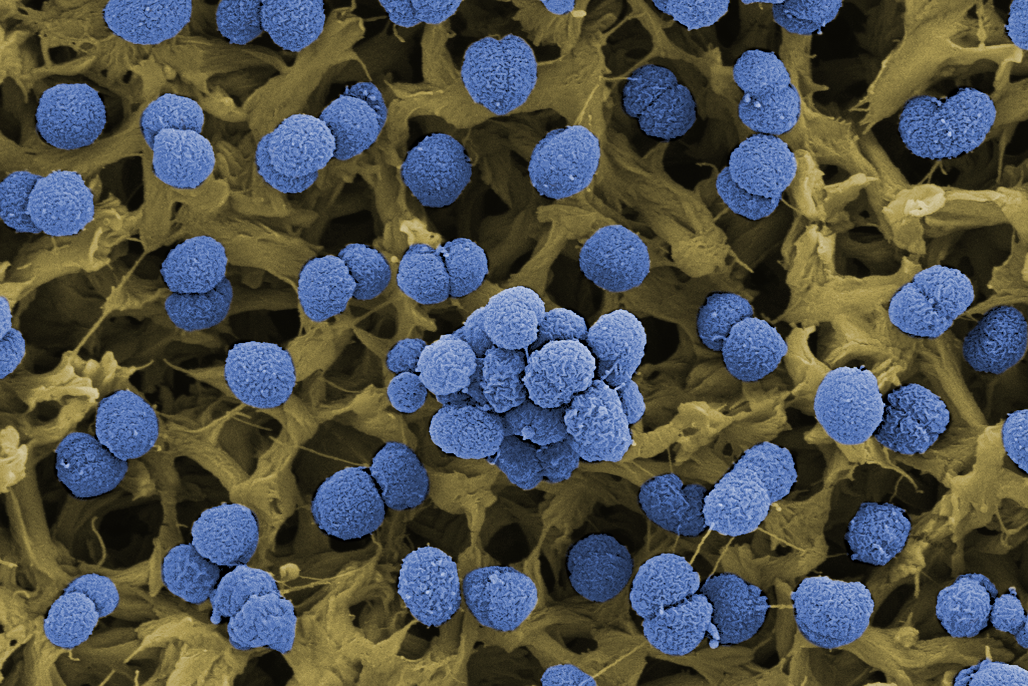 New clues point to a protective shield that could change harmless bacteria into killers