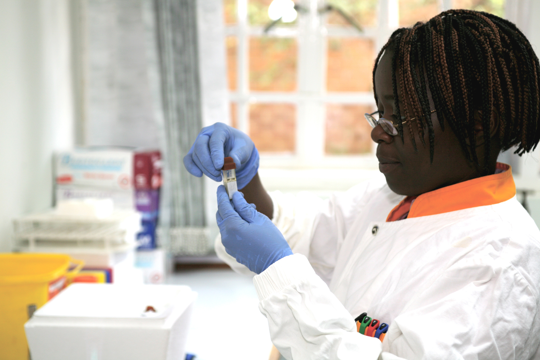 Call for manufacturers to develop new rapid diagnostic tests