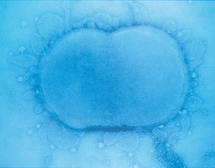 An image of meningococcal bacteria.