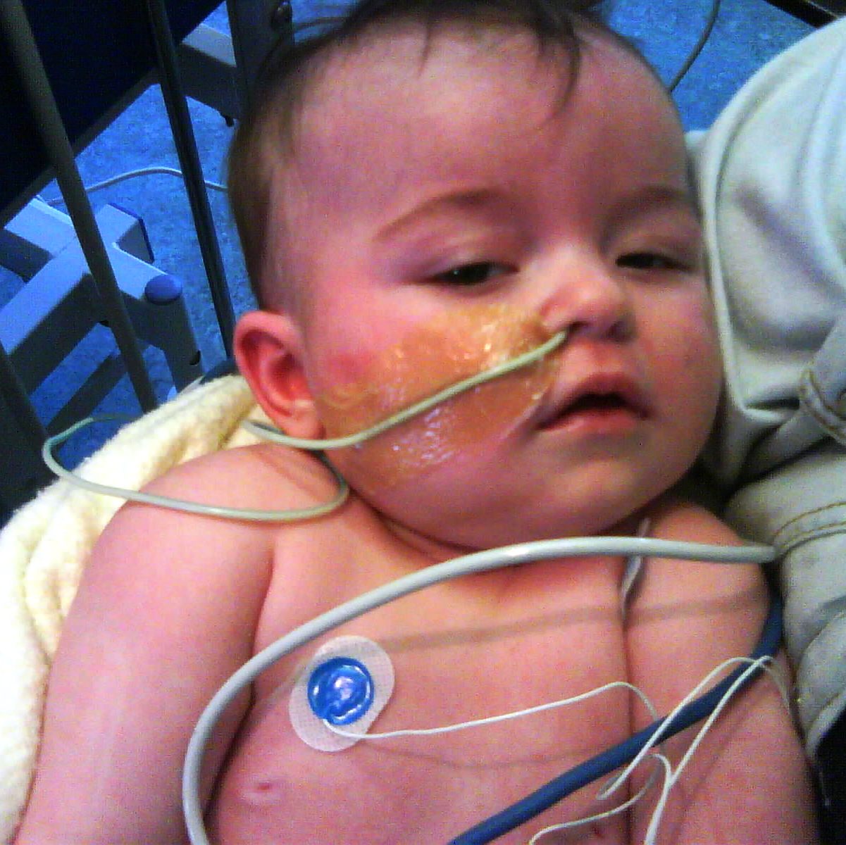 Baby Daisy Marshall in the hospital with lots of tubes around her