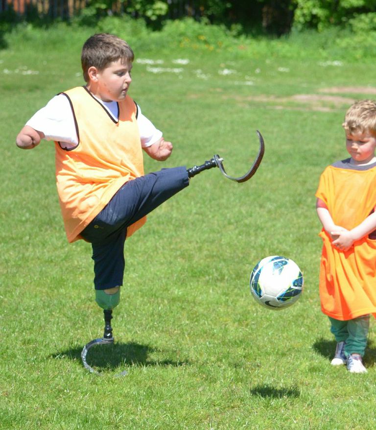 An image of a child wearing prosthetics and playing football