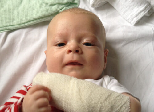 A picture of a baby with his arm in a bandage.