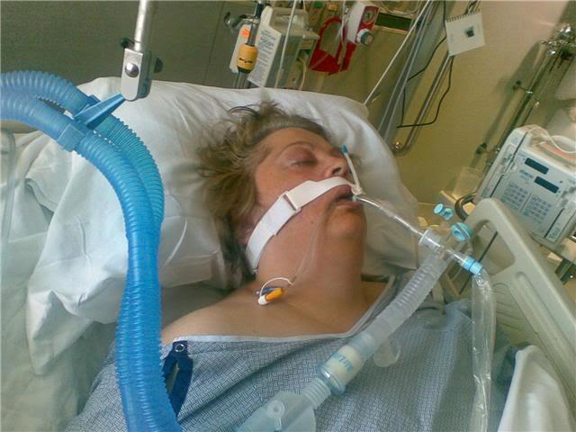 A photograph of Joyce in the hospital on life support.