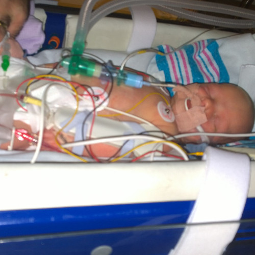 Baby Lucy Cummings in the hospital