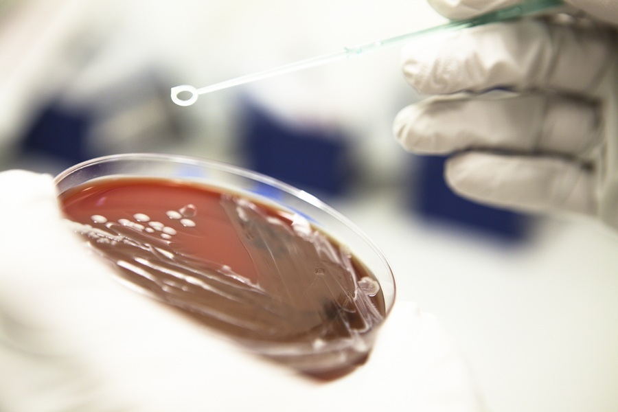 Gloved hands holding a full petri dish and sample tool. Petri dish has a red sample in it.