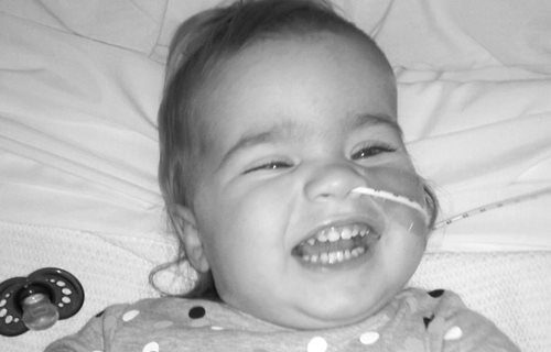 A black and white photograph of a baby with a breathing tube in her nose.
