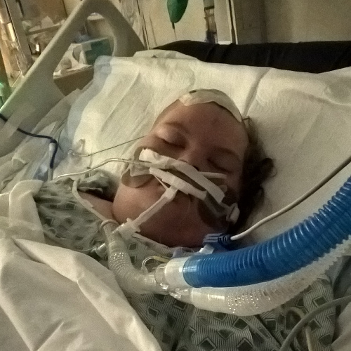 A photograph of Vanessa Jennings in hospital with lots of tubes attached to her