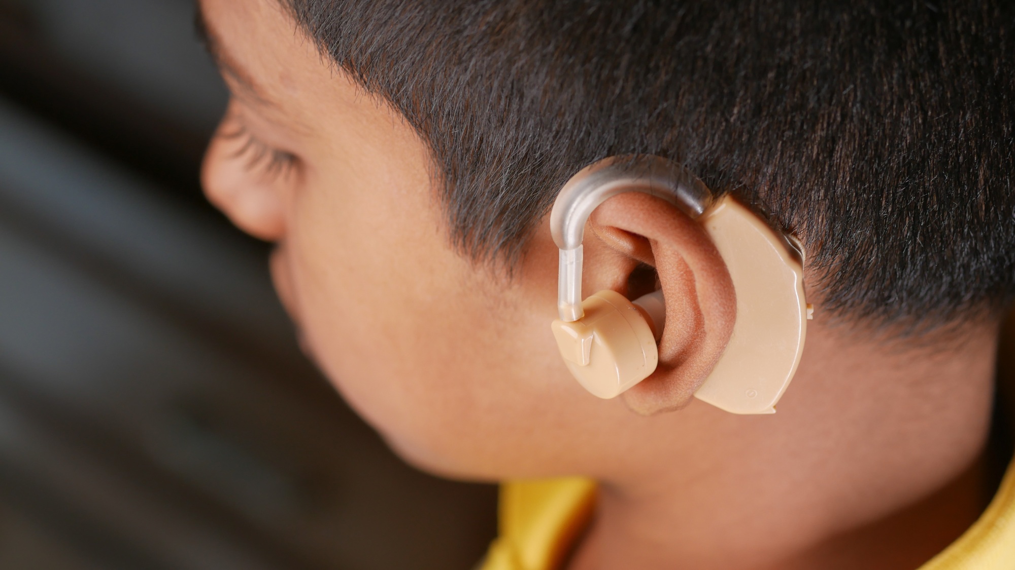 A boy with a hearing aid looking down.